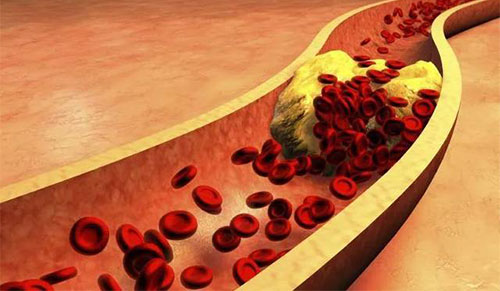 ���̴�Ϊʲô������ ���̴�����ô��